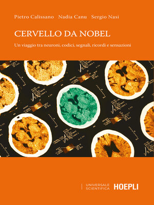 cover image of Cervello da Nobel